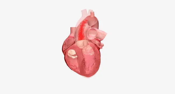 심장은 전체에 근육질의 기관이다 — 스톡 사진