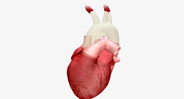 合成グラフトは 酸素化された血液が心臓から体の他の部分まで流れることを可能にする人工管です 3Dレンダリング — ストック写真