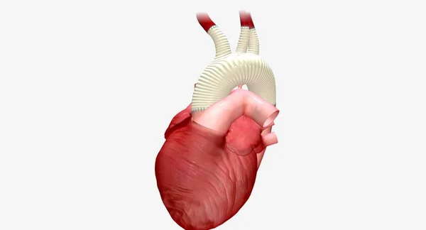 合成グラフトは 酸素化された血液が心臓から体の他の部分まで流れることを可能にする人工管です 3Dレンダリング — ストック写真