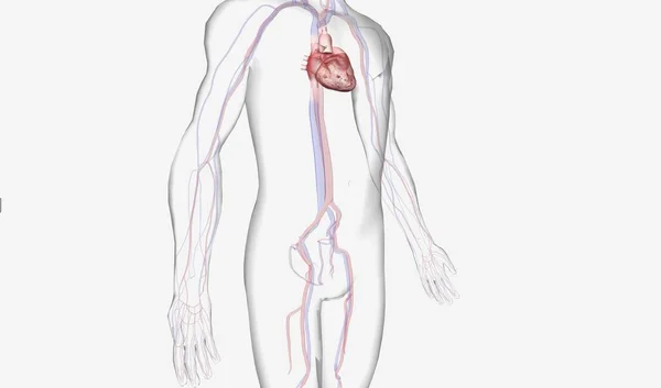 在心源性休克期间 Iabp提供帮助 当心脏无法向身体其他部位输送足够的血液时 就会出现严重的情况 3D渲染 — 图库照片