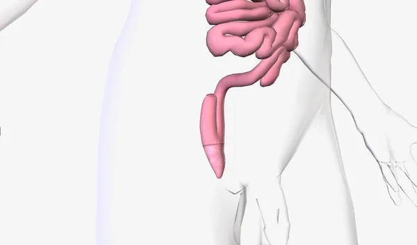 肛门吻合术允许切除大肠的上 3D渲染 — 图库照片