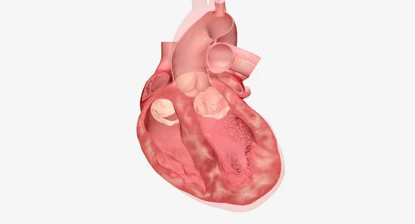 Καρδιακή Ανεπάρκεια Φάρμακα — Φωτογραφία Αρχείου