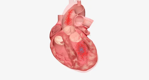 Heart Failure Medications — Stock Photo, Image