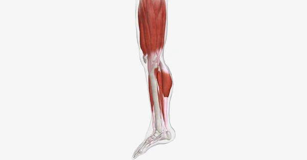 Uma Cãibra Muscular Uma Contração Súbita Dolorosa Involuntária Mais Músculos — Fotografia de Stock