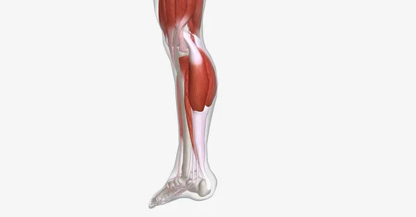 肌肉痉挛是一个或多个肌肉突然 疼痛和非自愿的收缩 3D渲染 — 图库照片