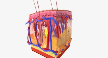 Angioedema is a swelling of the dermis and subcutaneous tissue.Anaphylaxis, Histamine Release and Vascular Edema 3D rendering