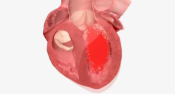 你的心脏是一个肌肉器官 负责将血液输送到全身 3D渲染 — 图库照片