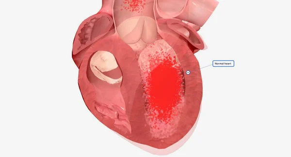 Kalbiniz Vücudunuza Kan Pompalamaktan Sorumlu Bir Kas Organıdır Hazırlama — Stok fotoğraf