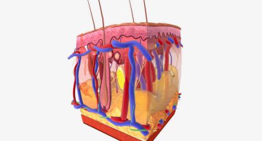 Angioedema is a swelling of the dermis and subcutaneous tissue.Anaphylaxis, Histamine Release and Vascular Edema 3D rendering