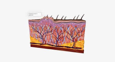 Cutaneous siğiller en dıştaki deri tabakasını (epidermis) etkiler. 3B görüntüleme