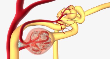 Glomerulonephritis is a group of renal conditions characterized by inflammation of the glomeruli within the kidney. 3D rendering