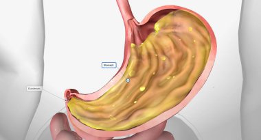 Midedeki B12 3D görüntüleme
