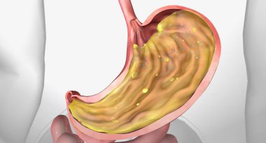 Midedeki B12 3D görüntüleme