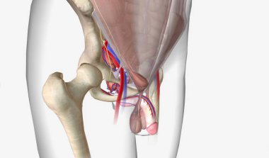 Kasık fıtığı, karın boşluğundaki bağırsak ya da yağ gibi doku karın duvarındaki zayıf bir noktayı ittiğinde ortaya çıkan yaygın bir durumdur. 3B Hazırlama