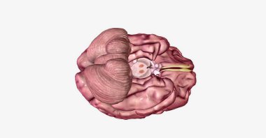 Lewy vücut bunaması, bilişsel becerilerdeki dalgalanmalar, halüsinasyonlar ve yürüyüş bozukluklarıyla karakterize edilen yaygın bir dejeneratif nörolojik hastalıktır. 3B görüntüleme
