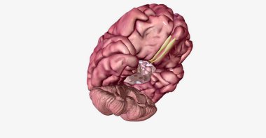 Lewy vücut bunaması, bilişsel becerilerdeki dalgalanmalar, halüsinasyonlar ve yürüyüş bozukluklarıyla karakterize edilen yaygın bir dejeneratif nörolojik hastalıktır. 3B görüntüleme