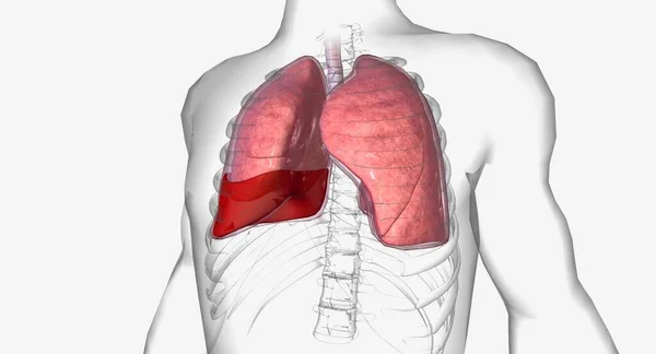 Hemothorax Plicní Onemocnění Při Kterém Kolem Plic Hromadí Krev Renderování — Stock fotografie