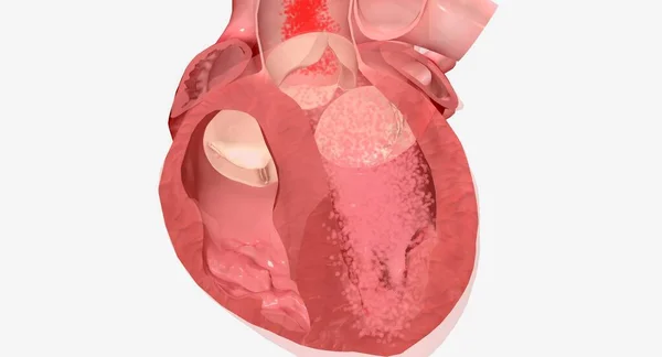 Vaše Srdce Svalový Orgán Který Zodpovědný Čerpání Krve Celého Těla — Stock fotografie