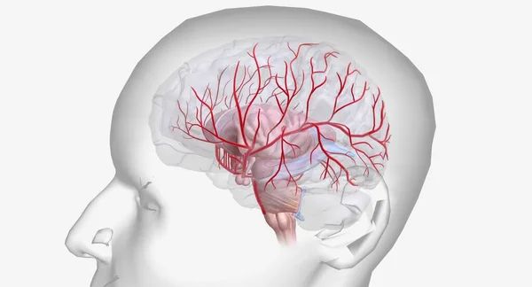 stock image Hemorrhagic stroke is an urgent medical condition characterized by bleeding inside or on the surface of the brain. 3D rendering