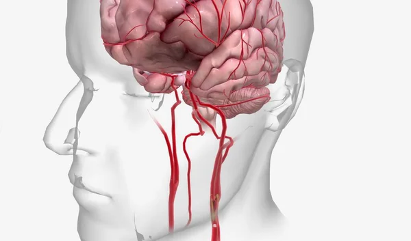 Perdita Afflusso Sangue Priva Cervello Ossigeno Che Può Portare Alla — Foto Stock