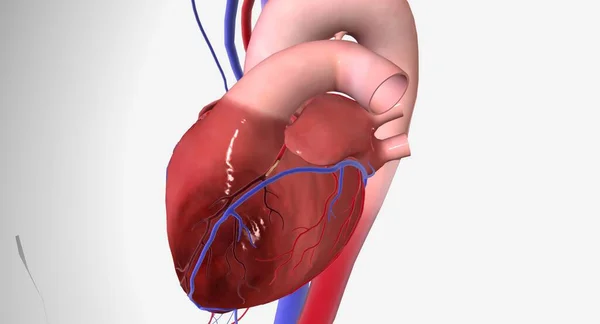 狭心症は 心臓への血流の減少による胸痛や不快感です 3Dレンダリング — ストック写真