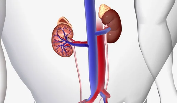 Kidney stones can become painful when traveling through the urinary tract but do not usually cause lasting damage. 3D Rendering