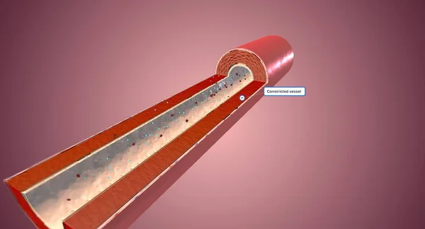 When high levels of angiotensin II are released into the bloodstream, blood vessels will constrict, resulting in high blood pressure. 3D rendering