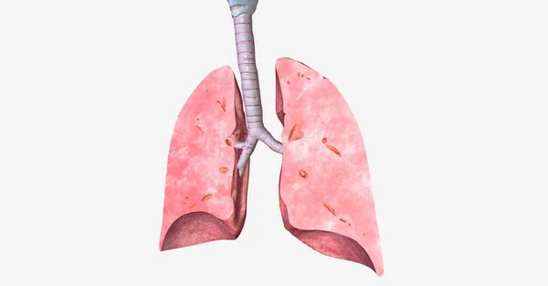 Humans Have Right Lung Left Lung Together Pair Occupies Majority — Stock Photo, Image