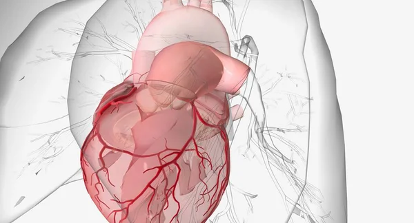 Stock image Idiopathic dilatation of the pulmonary artery (IDPA) is a rare congenital condition characterized by a pulmonary artery with an abnormally large diameter.