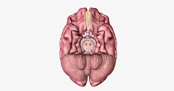 性痴呆是一种常见的变性神经疾病 其特点是认知能力 幻觉和步态紊乱 3D渲染 — 图库照片