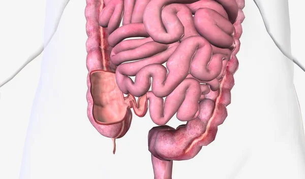 回肠瓣膜是位于小肠和大肠交界处的一种乳糖结构 具有生理性括约肌 3D渲染 — 图库照片