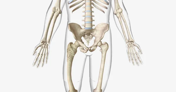 Paget Disease Bone Pdb Skeletal Disorder Characterized Abnormal Bone Growth — Stock Photo, Image
