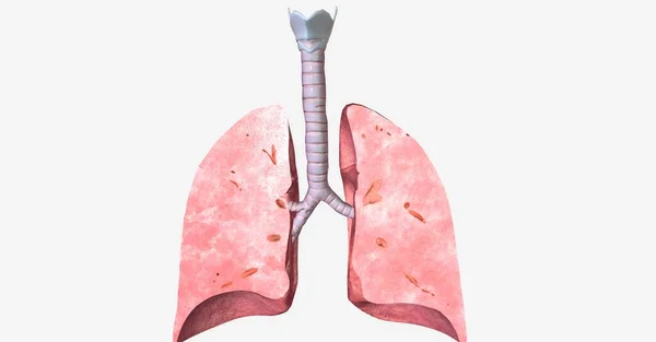 Humans Have Right Lung Left Lung Together Pair Occupies Majority — Stock Photo, Image