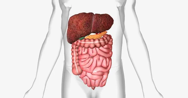 Cirrhosis Scarring Occurs Liver Tissue Tries Repair Itself Injury — Stock Photo, Image