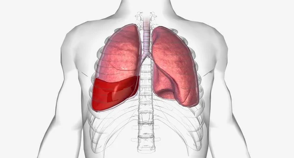 Hemotórax Uma Condição Pulmonar Qual Sangue Acumula Torno Dos Pulmões Imagem De Stock