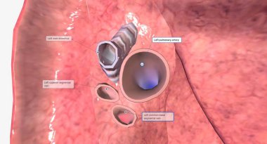 Her akciğerin hilumu akciğerlerin kenarına bakan orta veya mediastinumda bulunur. 3B görüntüleme
