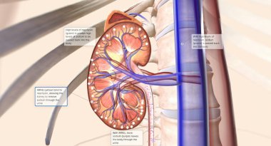 Angiotensin reseptör neprilysin inhibitörleri (ARNI 'lar) böbreğin idrar yolundaki ekstra sodyum taşınmasına yardım ederek işe yarayan bir kombinasyon ilaçtır. 3B görüntüleme