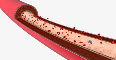 Akyuvar sayısındaki azalmaya lökselik denir. 3B görüntüleme
