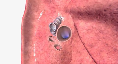 Her akciğerin hilumu akciğerlerin kenarına bakan orta veya mediastinumda bulunur. 3B görüntüleme