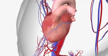 Miyokardiyal iskemi kalbe giden kan akışının azalmasından ve kalp kasına giden oksijensizlikten kaynaklanır. 3B görüntüleme
