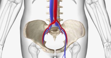 May Thurner syndrome is compression of the left common iliac vein between the right common iliac artery and the 5th lumbar vertebra of the spine. 3D rendering clipart
