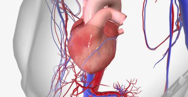 Myocardial ischemia is caused by reduced blood flow to the heart and a lack of oxygen to the heart muscle. 3D rendering clipart