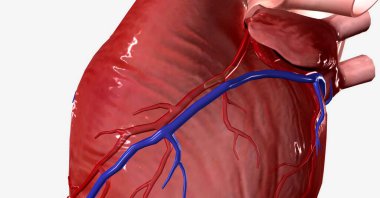 Once an atherosclerotic plaque reaches a certain size, it can occlude an artery completely or part of the plaque can rupture and form a clot, causing occlusion. 3D rendering clipart
