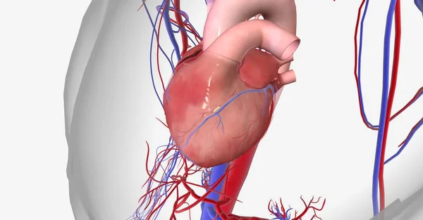 Isquemia Miocárdica Causada Por Reducción Del Flujo Sanguíneo Corazón Falta —  Fotos de Stock