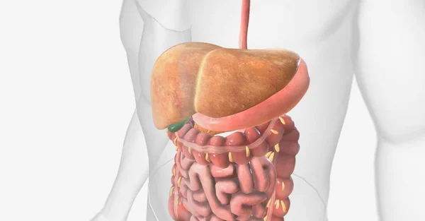 非酒精性脂肪肝 Nafld 是一种存在于肝脏中的多余脂肪细胞的疾病 3D渲染 — 图库照片