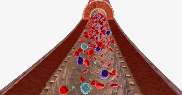 不正常的白血病细胞不能正常运作 不能控制地复制 挤走了骨髓和血液中的健康细胞 3D渲染 — 图库照片