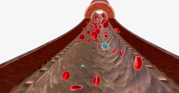 白血球数量的减少被称为白血病 3D渲染 — 图库照片
