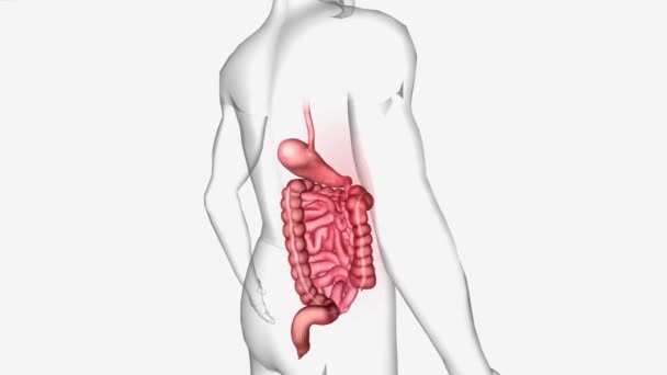 胃腸炎は下痢や嘔吐を引き起こす非常に一般的な状態です — ストック動画