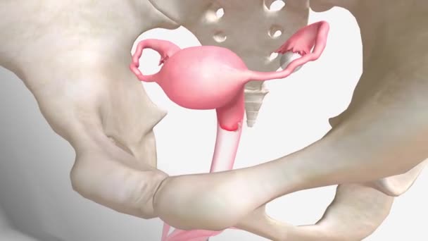 3D骨盆疼痛和炎症 — 图库视频影像