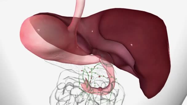 十二指腸がんステージ4がんは 肝臓全体を含む身体の他の領域にも広がっています — ストック動画